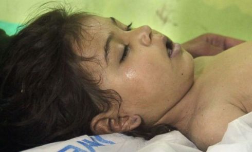 gty-syria-chemical-child-ps-170404_12x5_992