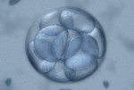 Legal Representation For Fetus Of Brain-Dead Women, Or The Next Step In “Personhood”